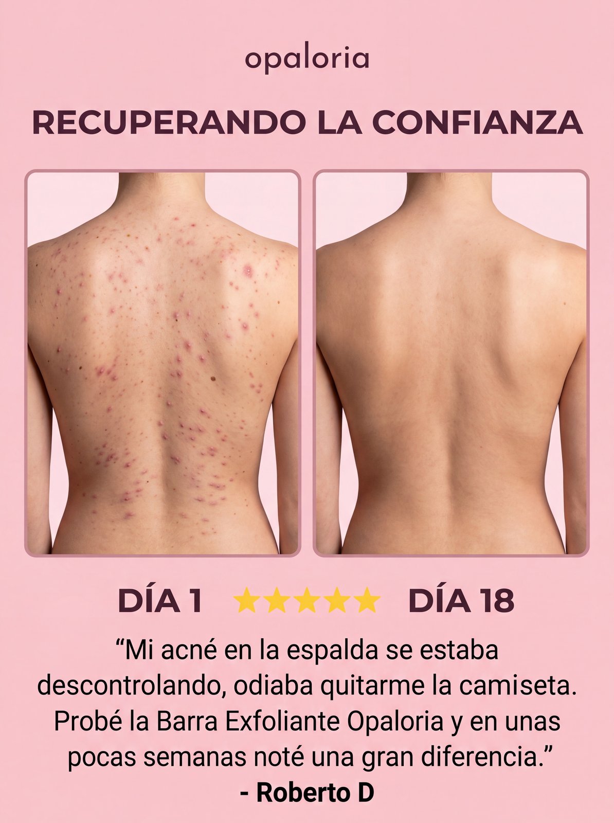 Roberto D — 18 días con Opaloria