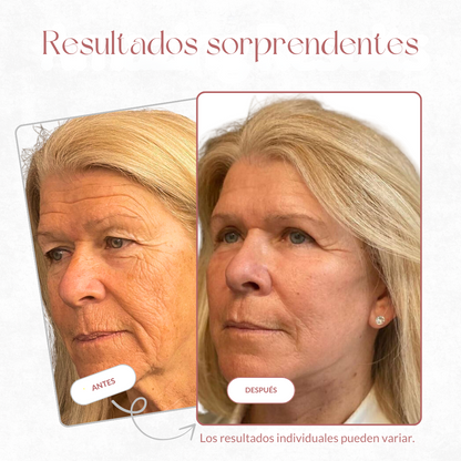 Multicalcio Stick – Bálsamo Reafirmante & Reparador Cemenrete