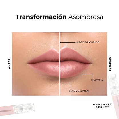 VoluLips- kit profesional voluminizador de labios. ®