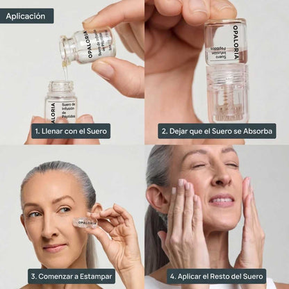 Sistema de Microinfusión Opaloria