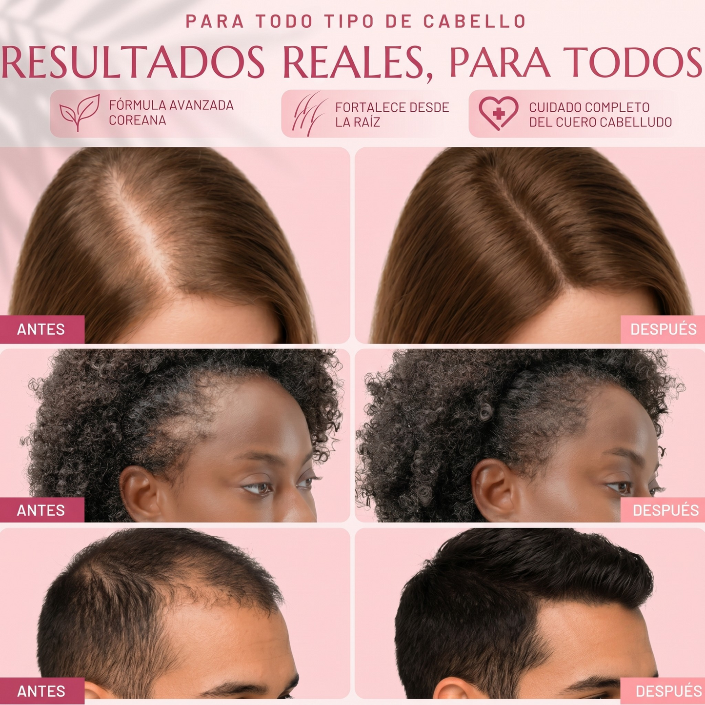 Serum Capilar Anticaída Opaloria · Aplicador Brush con Fórmula Coreana