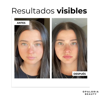 VoluLips- kit profesional voluminizador de labios. ®