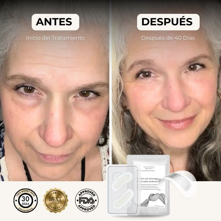 Parches Opaloria Beauty