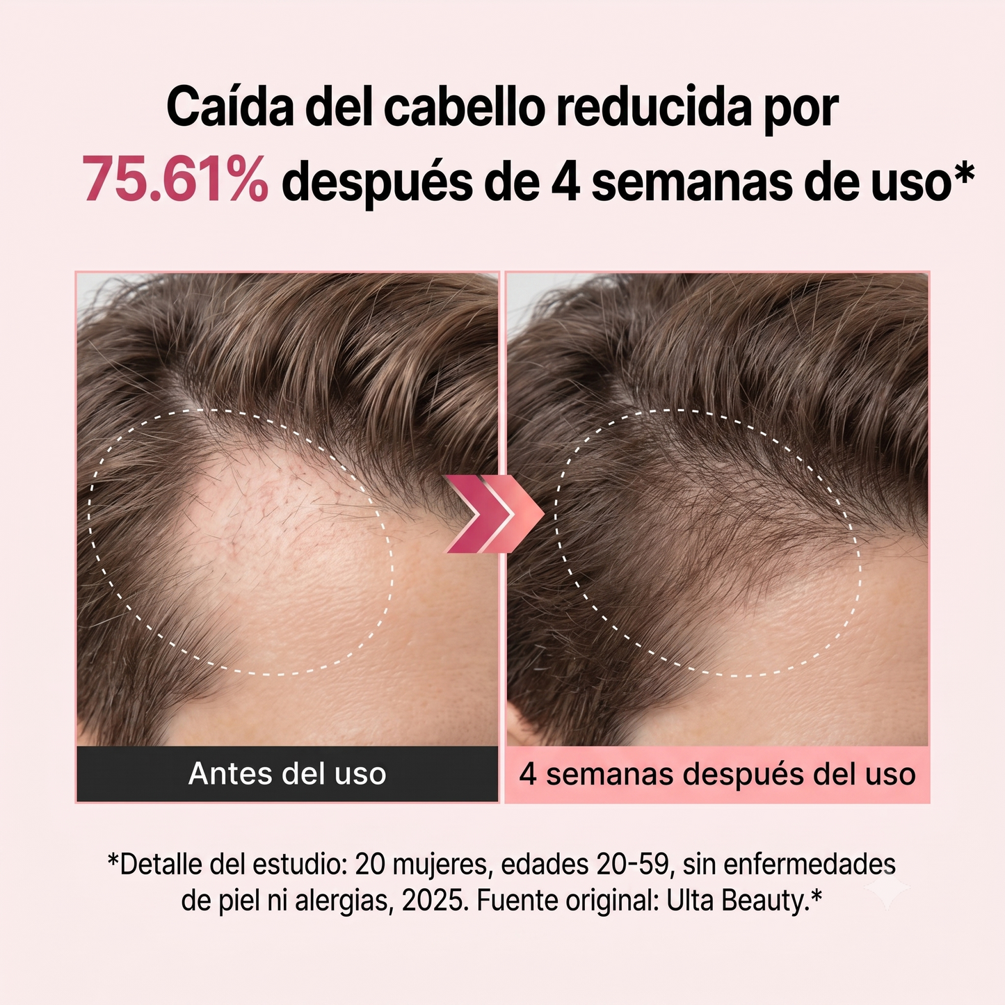 Serum Capilar Anticaída Opaloria · Aplicador Brush con Fórmula Coreana