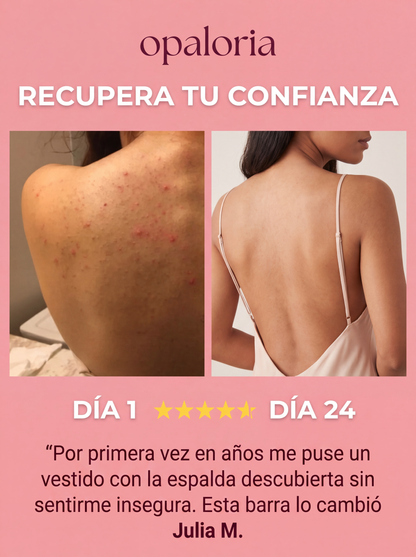 Barra Anti Granos y Manchas – Espalda libre