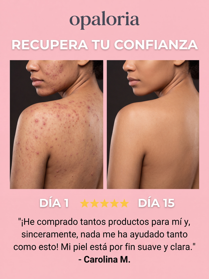Barra Anti Granos y Manchas – Espalda libre