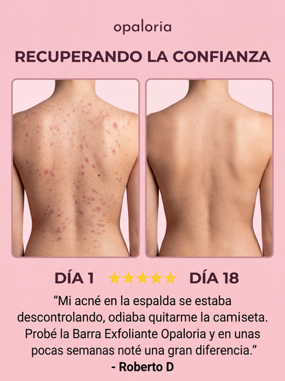 Barra Anti Granos y Manchas – Espalda libre